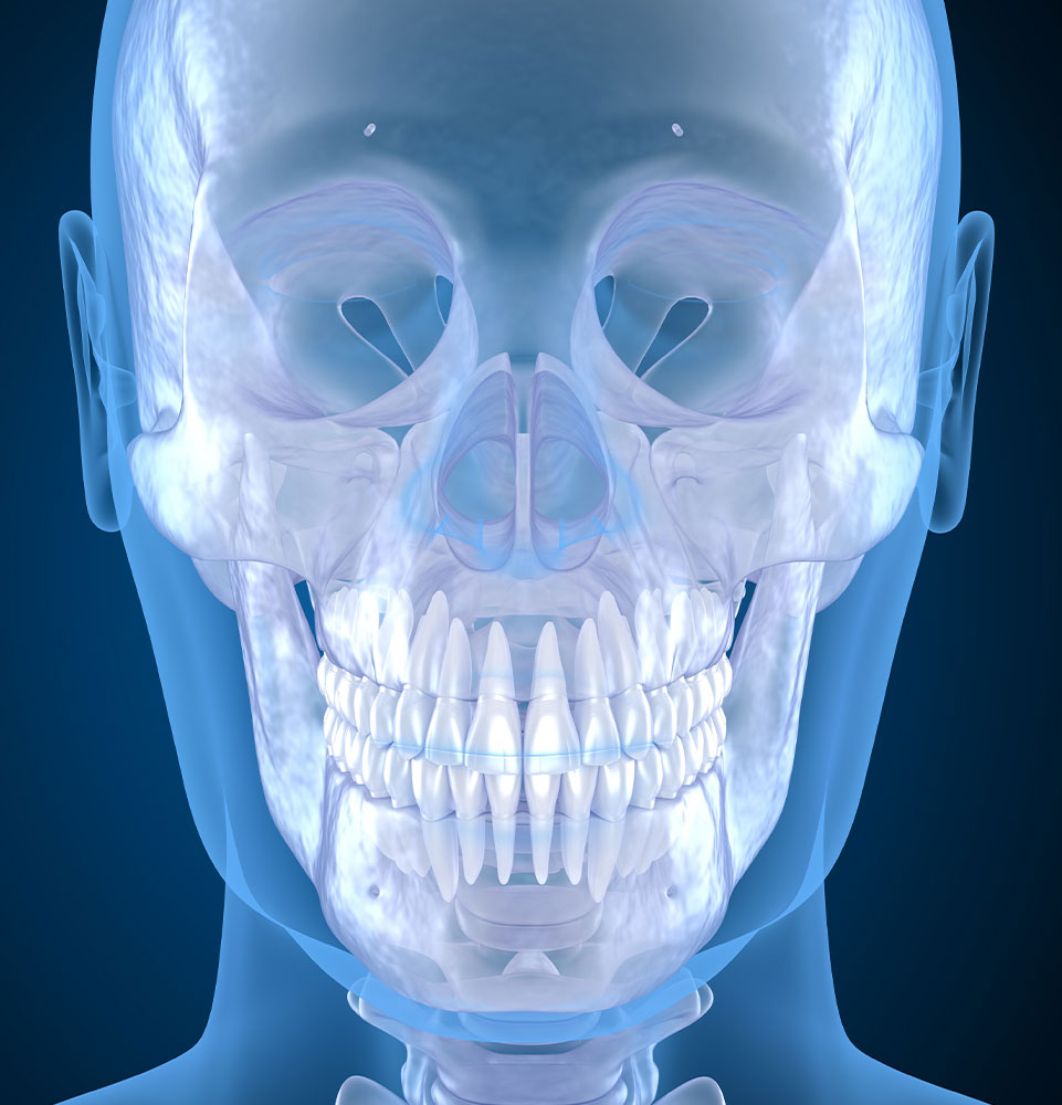oral jaw surgery 3d